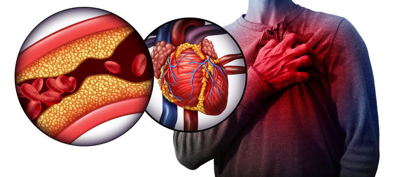 हृदयविकाराचा झटका येणे – Heart Attack