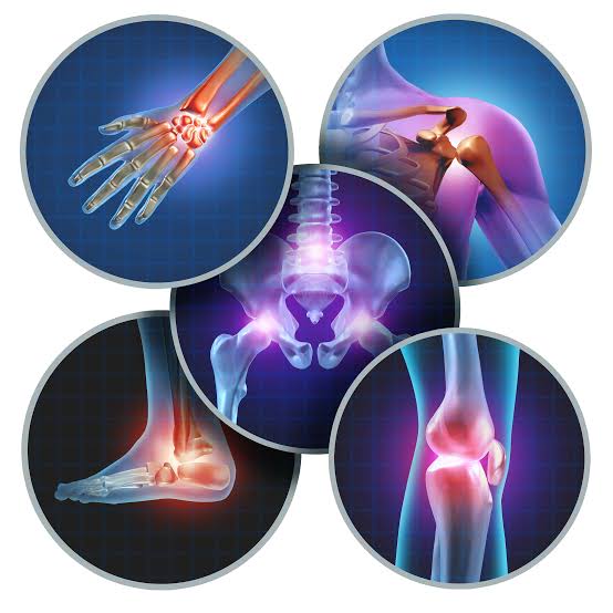 आमवात – Rheumatoid arthritis