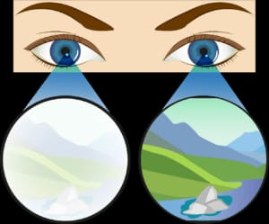 आळशी डोळा (Amblyopia)