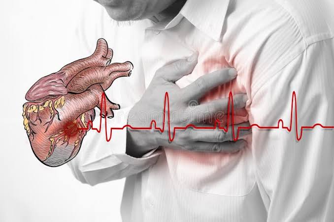 हृदयविकाराचा झटका येणे – Heart Attack