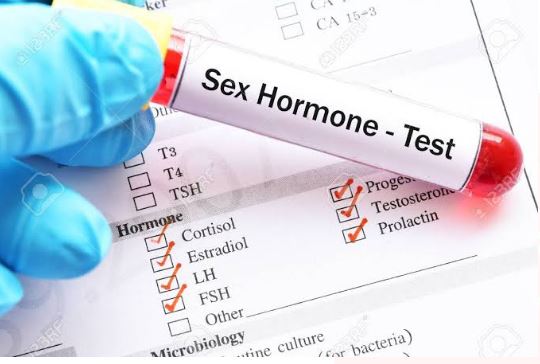 Hormonal Assays Test